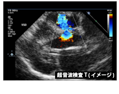 エコー画像